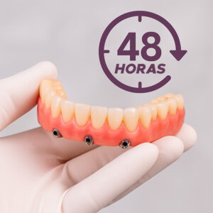 Implante Dentario em 48 horas