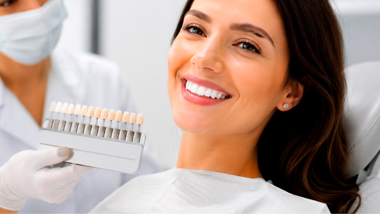 Clareamento dental em belo horizonte / nova lima
